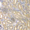 Interleukin 12 Receptor Subunit Beta 1 antibody, A1886, ABclonal Technology, Immunohistochemistry paraffin image 