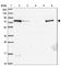 Zinc Finger CCCH-Type Containing 14 antibody, HPA049798, Atlas Antibodies, Western Blot image 