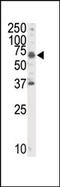 Receptor Like Tyrosine Kinase antibody, AP14422PU-N, Origene, Western Blot image 