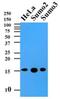 Small Ubiquitin Like Modifier 2 antibody, NBP2-22546, Novus Biologicals, Western Blot image 