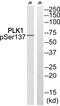Polo Like Kinase 1 antibody, PA5-40163, Invitrogen Antibodies, Western Blot image 