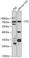 Coagulation Factor X antibody, GTX32595, GeneTex, Western Blot image 