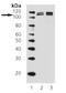 Lysine Demethylase 1A antibody, M00532, Boster Biological Technology, Western Blot image 