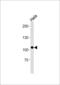 Ubiquitin Protein Ligase E3C antibody, LS-C204005, Lifespan Biosciences, Western Blot image 