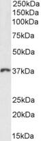 Homeobox D13 antibody, NBP2-75091, Novus Biologicals, Western Blot image 