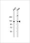 Integrator Complex Subunit 6 antibody, MBS9217014, MyBioSource, Western Blot image 