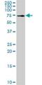 Slingshot Protein Phosphatase 3 antibody, H00054961-D01P, Novus Biologicals, Western Blot image 