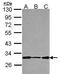 Defective In Cullin Neddylation 1 Domain Containing 1 antibody, PA5-30744, Invitrogen Antibodies, Western Blot image 