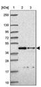 Inositol-Tetrakisphosphate 1-Kinase antibody, PA5-63091, Invitrogen Antibodies, Western Blot image 