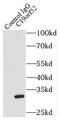 Translocase Of Inner Mitochondrial Membrane 29 antibody, FNab01052, FineTest, Immunoprecipitation image 