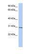 TRNA Methyltransferase 61A antibody, orb325435, Biorbyt, Western Blot image 