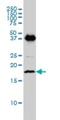 Epithelial Membrane Protein 3 antibody, H00002014-M01, Novus Biologicals, Western Blot image 