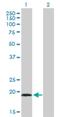 Tubulin Polymerization Promoting Protein Family Member 3 antibody, H00051673-B02P, Novus Biologicals, Western Blot image 