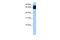 Tetratricopeptide Repeat Domain 12 antibody, A13538, Boster Biological Technology, Western Blot image 