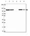 Glucosidase II Alpha Subunit antibody, HPA061426, Atlas Antibodies, Western Blot image 