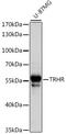 Thyrotropin Releasing Hormone Receptor antibody, LS-C750205, Lifespan Biosciences, Western Blot image 