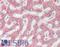 Glutathione S-transferase P 1 antibody, LS-B12969, Lifespan Biosciences, Immunohistochemistry paraffin image 