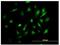 Bone Marrow Stromal Cell Antigen 2 antibody, ab88523, Abcam, Immunocytochemistry image 