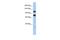 Zinc Finger RNA Binding Protein antibody, A07922, Boster Biological Technology, Western Blot image 