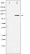 Signal Transducer And Activator Of Transcription 5B antibody, GTX52362, GeneTex, Western Blot image 