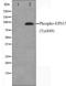 Epidermal Growth Factor Receptor Pathway Substrate 15 antibody, orb229635, Biorbyt, Western Blot image 
