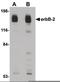 ERBB2 antibody, PA5-20740, Invitrogen Antibodies, Western Blot image 