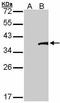 Transcription Factor B2, Mitochondrial antibody, GTX107714, GeneTex, Western Blot image 
