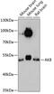 Adenylate Kinase 8 antibody, 15-188, ProSci, Western Blot image 