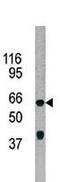 AarF Domain Containing Kinase 5 antibody, LS-C98091, Lifespan Biosciences, Western Blot image 