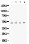 Ribonucleotide Reductase Regulatory Subunit M2 antibody, PB9817, Boster Biological Technology, Western Blot image 