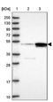 Cleavage Stimulation Factor Subunit 1 antibody, NBP2-33486, Novus Biologicals, Western Blot image 