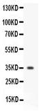 CD47 Molecule antibody, PA2223, Boster Biological Technology, Western Blot image 