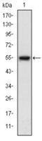 Mitogen-Activated Protein Kinase Kinase Kinase 5 antibody, GTX60456, GeneTex, Western Blot image 