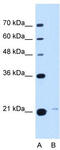 Transmembrane P24 Trafficking Protein 3 antibody, TA341889, Origene, Western Blot image 