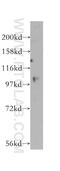 Ubiquitin Specific Peptidase 33 antibody, 12060-2-AP, Proteintech Group, Western Blot image 