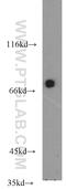 Lymphocyte Cytosolic Protein 2 antibody, 12728-1-AP, Proteintech Group, Western Blot image 