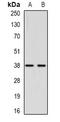 Aminoacylase 1 antibody, orb377895, Biorbyt, Western Blot image 