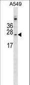 Calmodulin Like 6 antibody, LS-C157600, Lifespan Biosciences, Western Blot image 