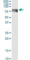 Protein Tyrosine Kinase 2 antibody, H00005747-M01, Novus Biologicals, Immunoprecipitation image 