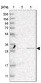 Thiopurine S-Methyltransferase antibody, PA5-54097, Invitrogen Antibodies, Western Blot image 