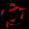 Collagen Type I Alpha 2 Chain antibody, LS-C352021, Lifespan Biosciences, Immunofluorescence image 