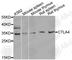 Cytotoxic T-Lymphocyte Associated Protein 4 antibody, A2063, ABclonal Technology, Western Blot image 