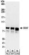 Rho GTPase Activating Protein 26 antibody, NBP2-32229, Novus Biologicals, Western Blot image 