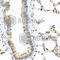 Transcriptional And Immune Response Regulator antibody, A6241, ABclonal Technology, Immunohistochemistry paraffin image 