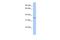 Glycosyltransferase 6 Domain Containing 1 antibody, A15163, Boster Biological Technology, Western Blot image 