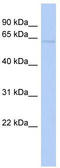 Zinc transporter ZIP4 antibody, TA333767, Origene, Western Blot image 