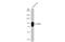 Polymeric Immunoglobulin Receptor antibody, GTX110197, GeneTex, Western Blot image 