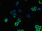 Solute Carrier Family 51 Beta Subunit antibody, orb46423, Biorbyt, Immunocytochemistry image 
