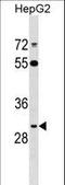 ADP Ribosylation Factor Like GTPase 10 antibody, LS-B10369, Lifespan Biosciences, Western Blot image 