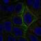 Adenylate Cyclase 5 antibody, NBP2-57976, Novus Biologicals, Immunocytochemistry image 